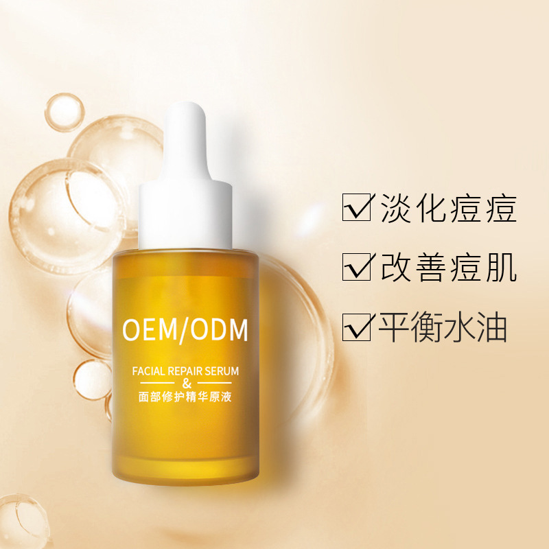 河北区_祛痘精华原液OEM